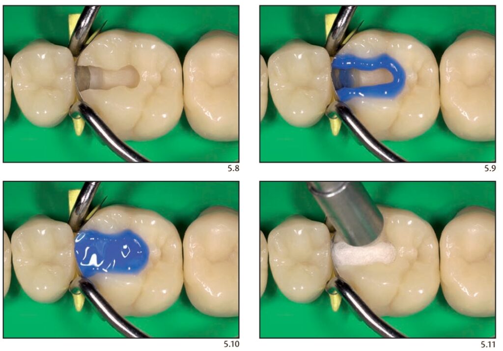 passos para adesao clinica