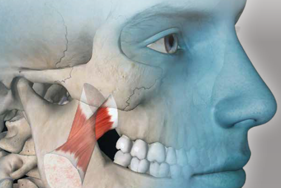 Dores musculares miofasciais são tendinopatias? Em busca de respostas