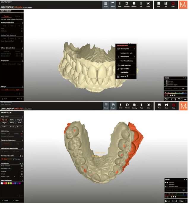Acima: os escaneamentos intraorais se articulam virtualmente. Abaixo: as cúspides dos dentes se sobrepondo (em laranja mostrando como a IA constrói o paciente virtual.
