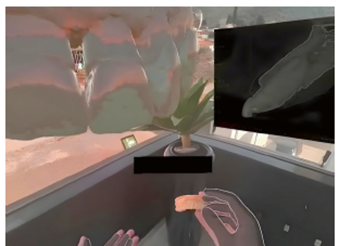 Modelo digital sobreposto ao ambiente real através de realidade aumentada integrando dados clínicos de diversas fontes.