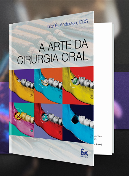O aumento no seio maxilar é um dos temas do livro "Arte da Cirurgia Oral". Foto de capa: Santos Publicações Ltda.