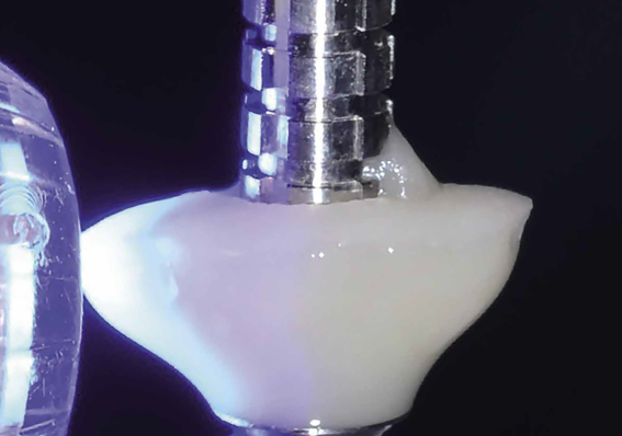 Preservação alveolar com cicatrizadores personalizados